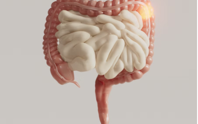 I diagnose Colorectal Cancer…here is what NOT to do