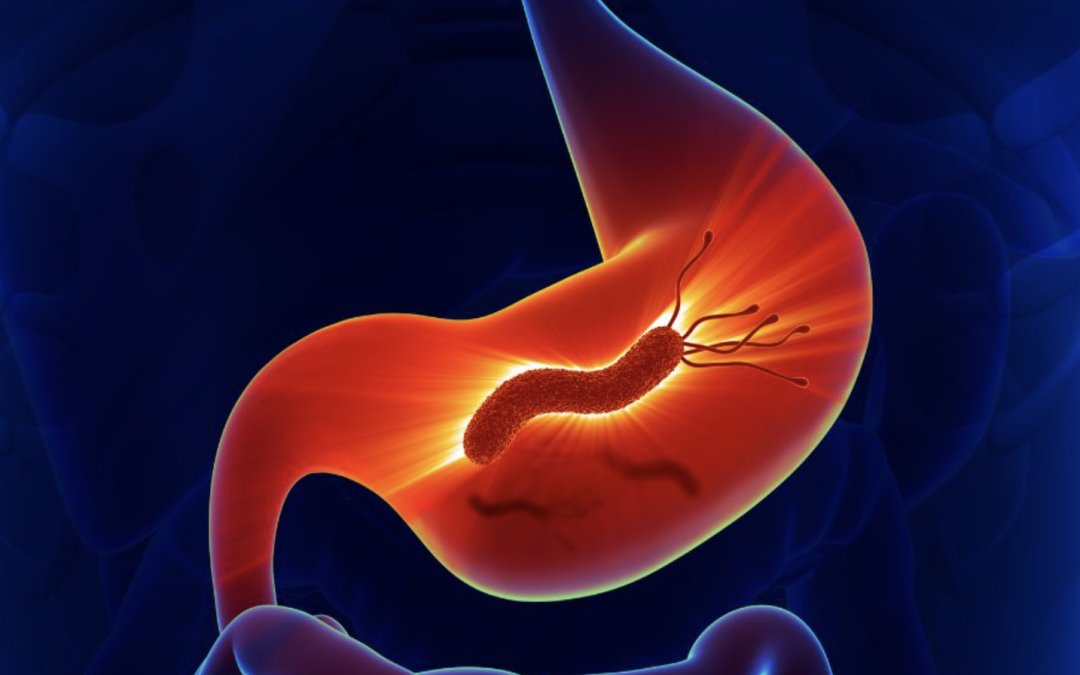 The Bug That Changed Everything We Knew About Stomach Problems